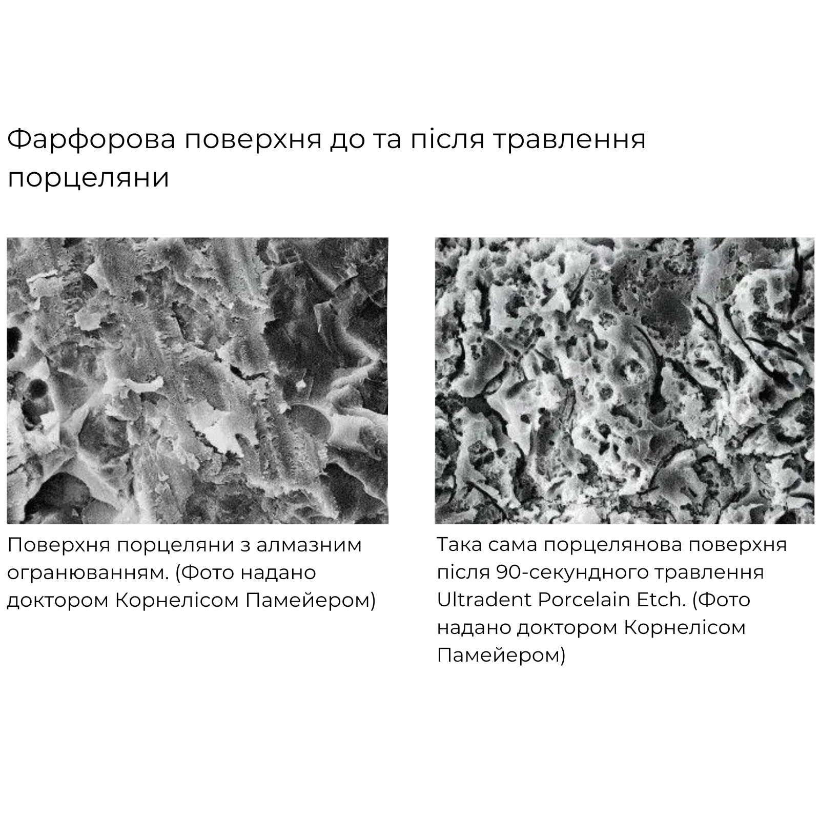 Плавикова кислота Porcelan Etch, протравка для реставрації металокераміки, шприц 1,2 мл (1,33 г), 2 насадки на шприц, артикул 406-1