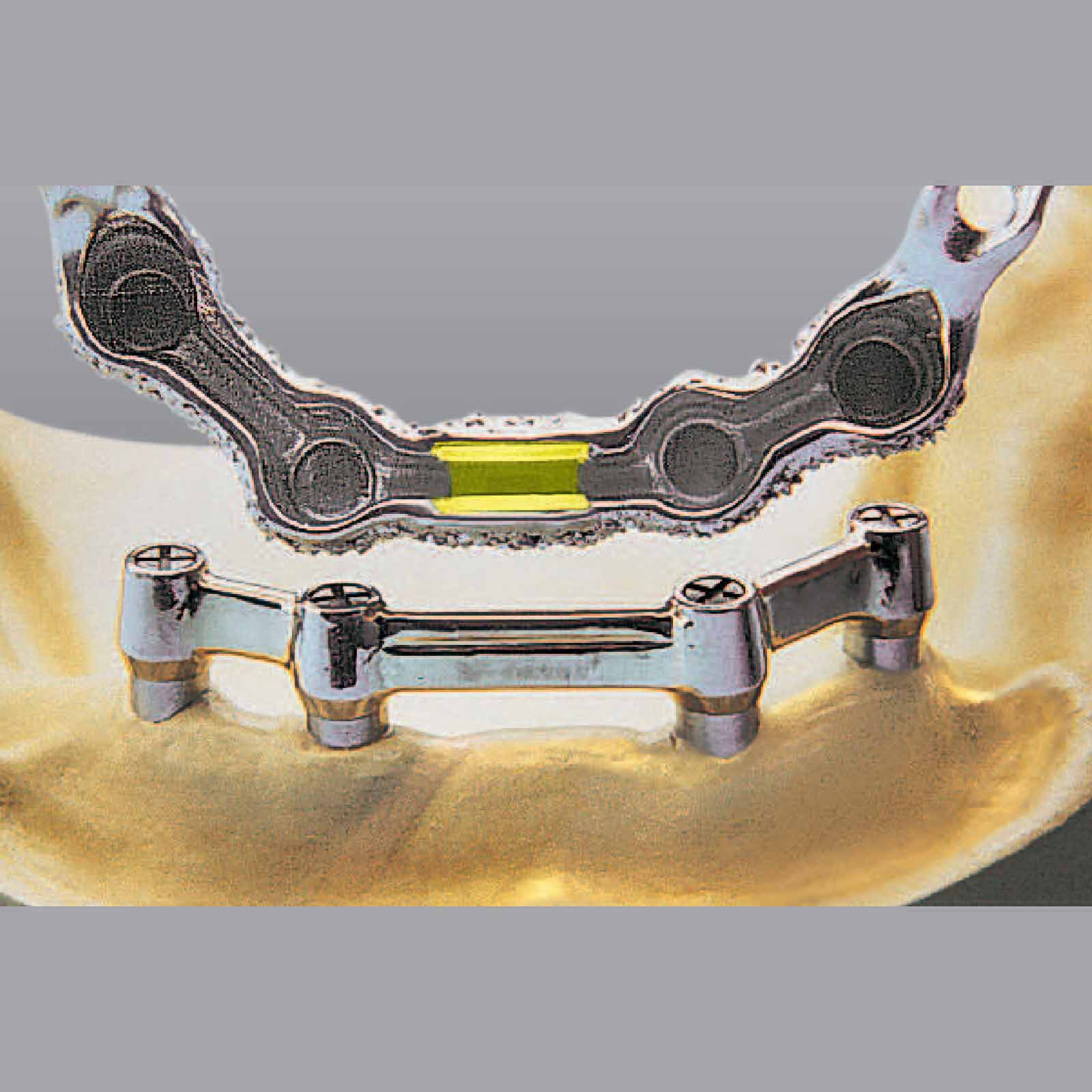 Матриця Vario-Soft-Bar-Pattern vsp-fs, червона