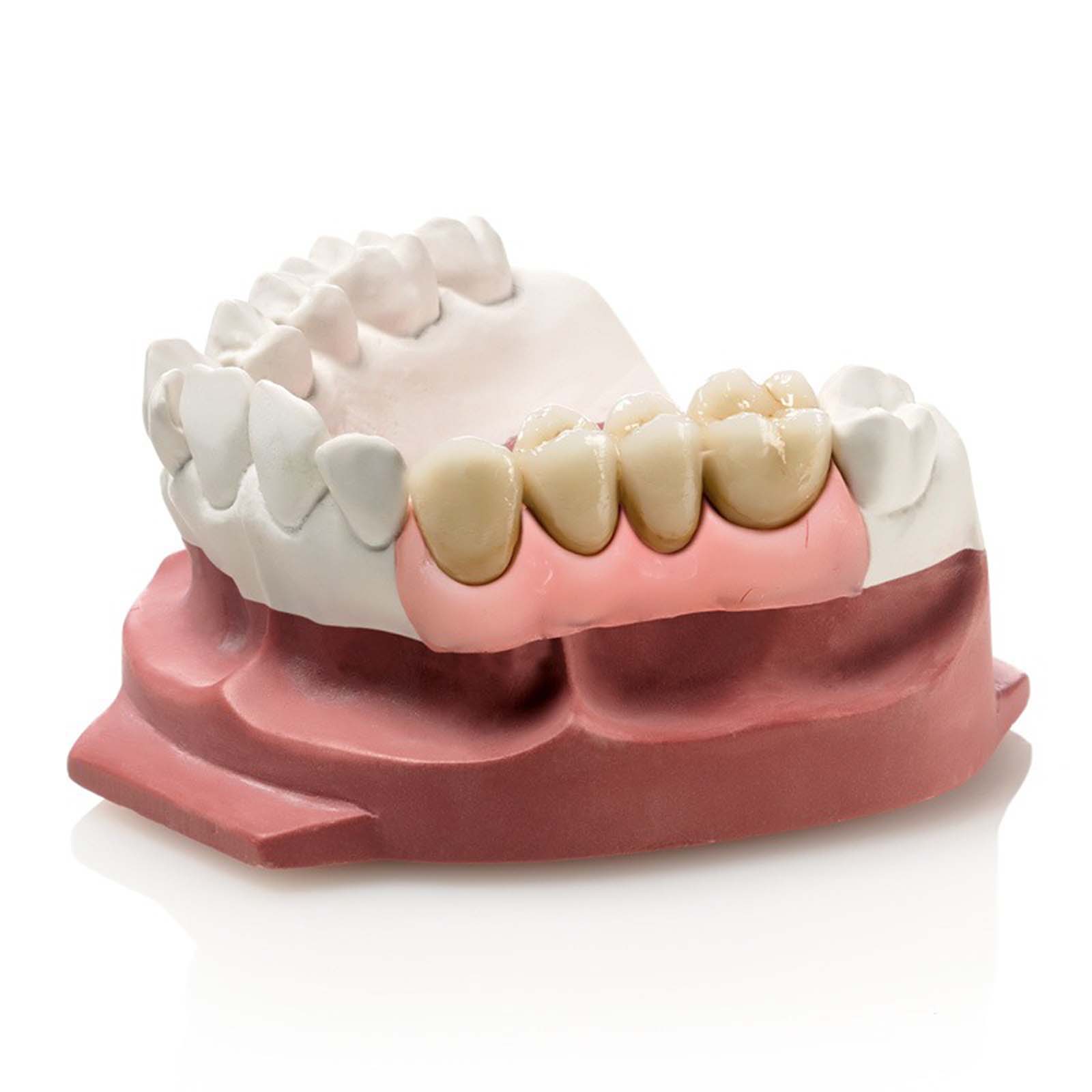 М'який А-силікон GINGIFAST ELASTIC, 2 картриджа по 50 мл