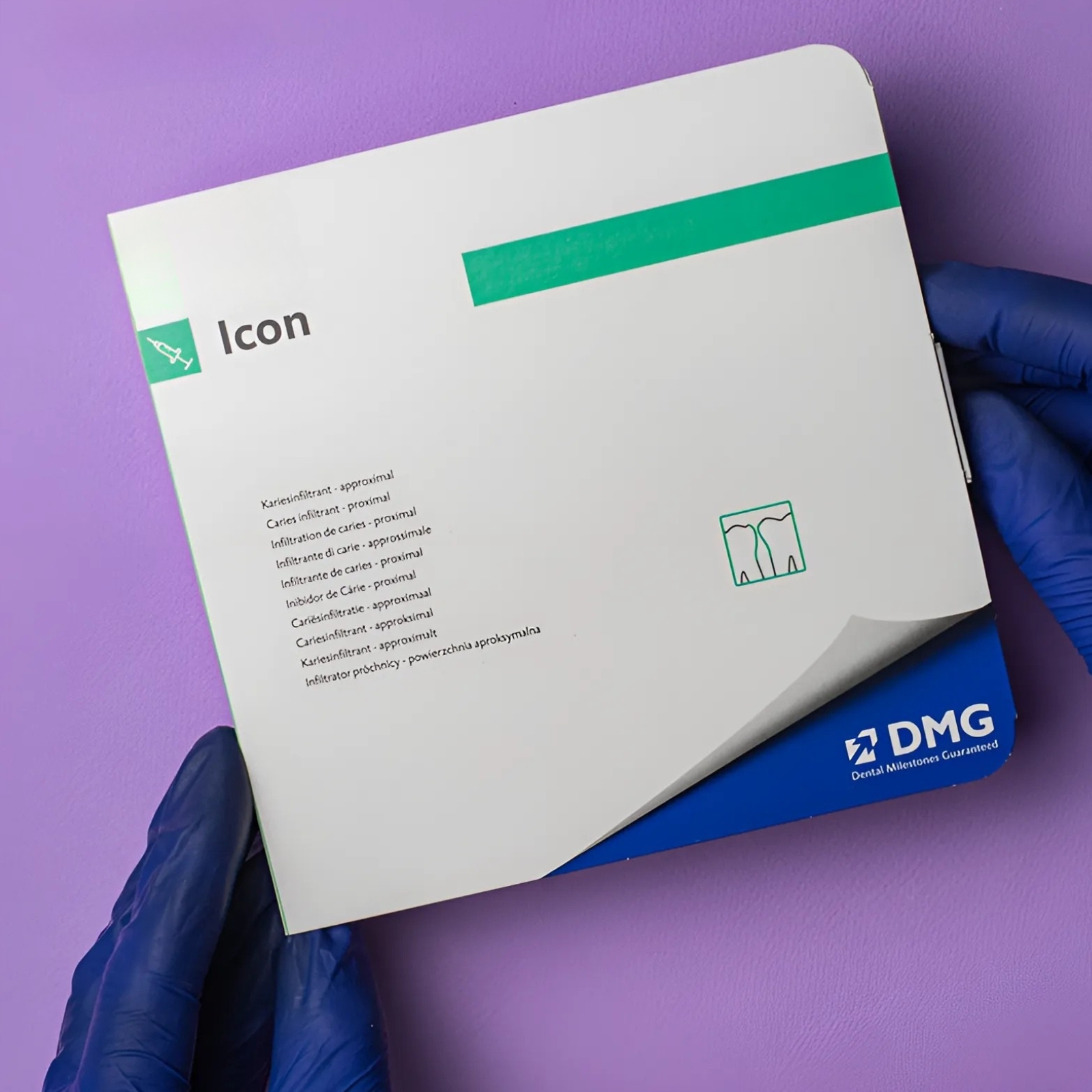 Icon infiltrant-proximal (Айкон інфільтрант-проксимальний), інфільтрація карієсу проксимальних поверхонь