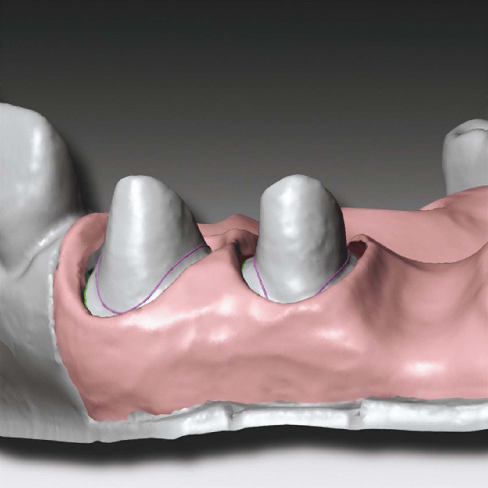 Скануючий твердий А-силікон GingiFast CAD Rigid, 2 картриджа по 50 мл