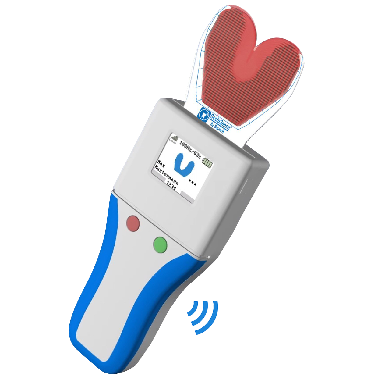OccluSense (Оклюсенс) прилад для діагностики, запису та відображення оклюзії