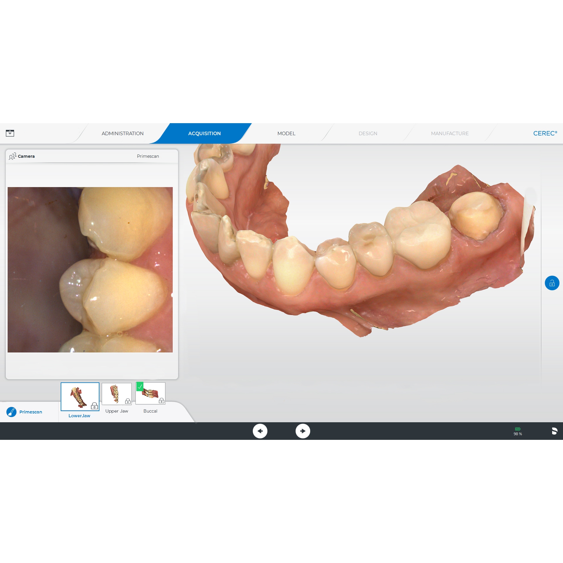 Сканер стоматологічний Primescan AC (Dentsply Sirona). Мобільний моноблок + батарея; інтраоральний, цифровий, оптичний сканер для отримання цифрових відбитків; з програмним забезпеченням Connect, можливість експорту даних в STL