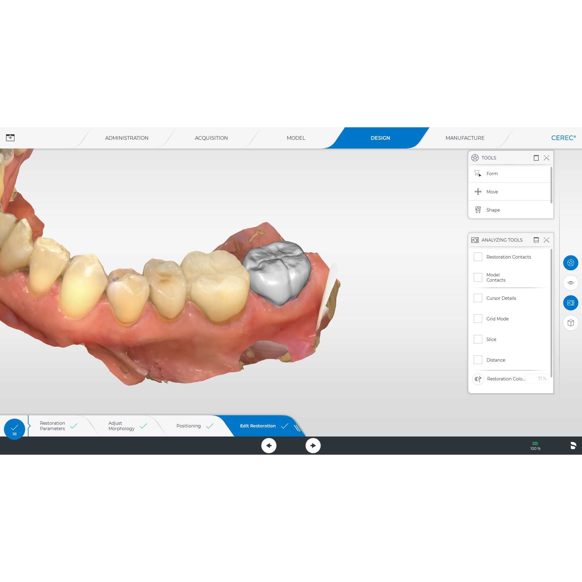 Сканер стоматологічний Primescan AC (Dentsply Sirona). Мобільний моноблок + батарея; інтраоральний, цифровий, оптичний сканер для отримання цифрових відбитків; з програмним забезпеченням Connect, можливість експорту даних в STL