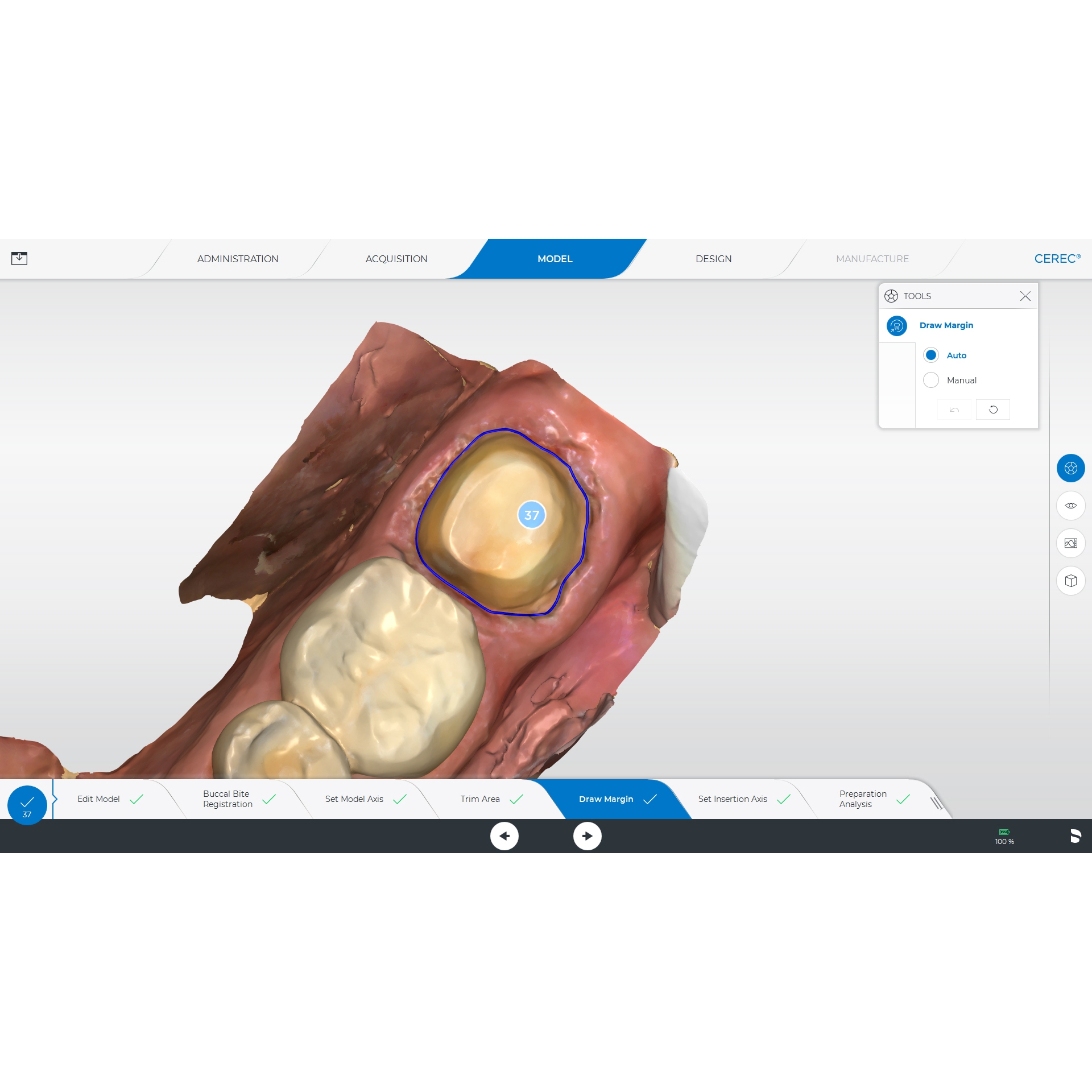 Сканер стоматологічний CEREC Primescan AC (Dentsply Sirona). Мобільний моноблок; інтраоральний, цифровий, оптичний сканер для отримання цифрових відбитків; ПЗ CEREC для моделювання реставрацій