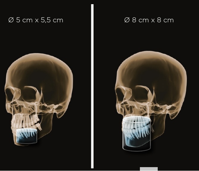 Рентген томограф ORTHOPHOS S 3D 8х8, об'єм зйомки: 5х5,5, 8х8 см (Dentsply Sirona)