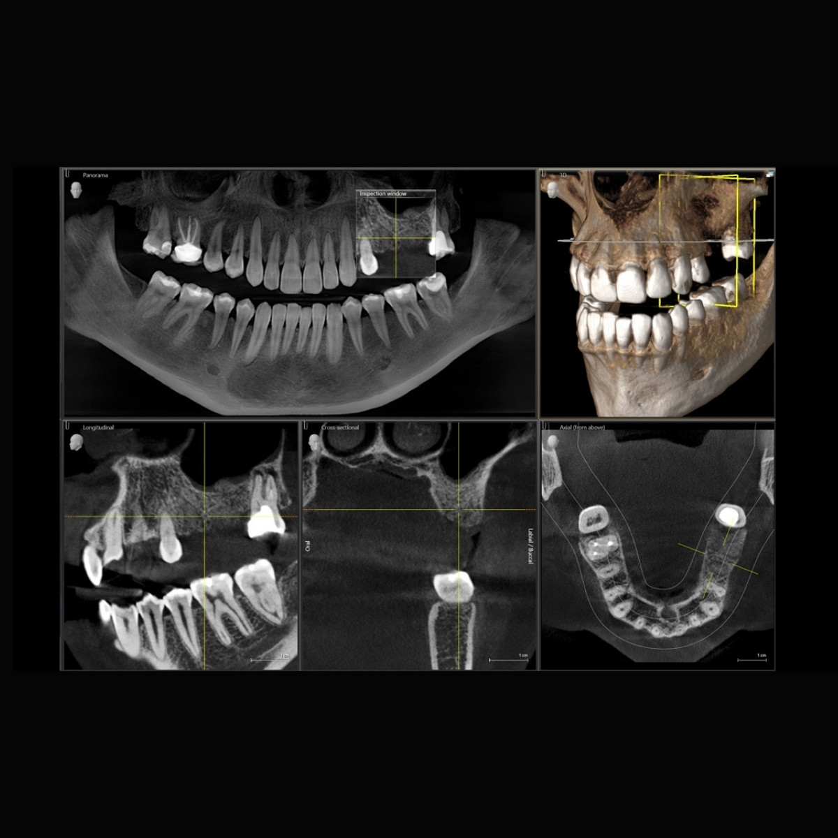 Рентген томограф ORTHOPHOS S 3D 8х8, об'єм зйомки: 5х5,5, 8х8 см (Dentsply Sirona)