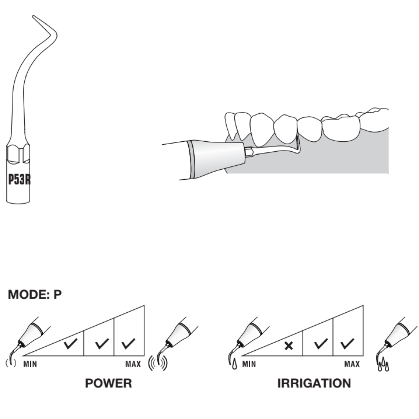 Насадка Woodpecker P53R, для скалера PT5, різьба EMS Woodpecker