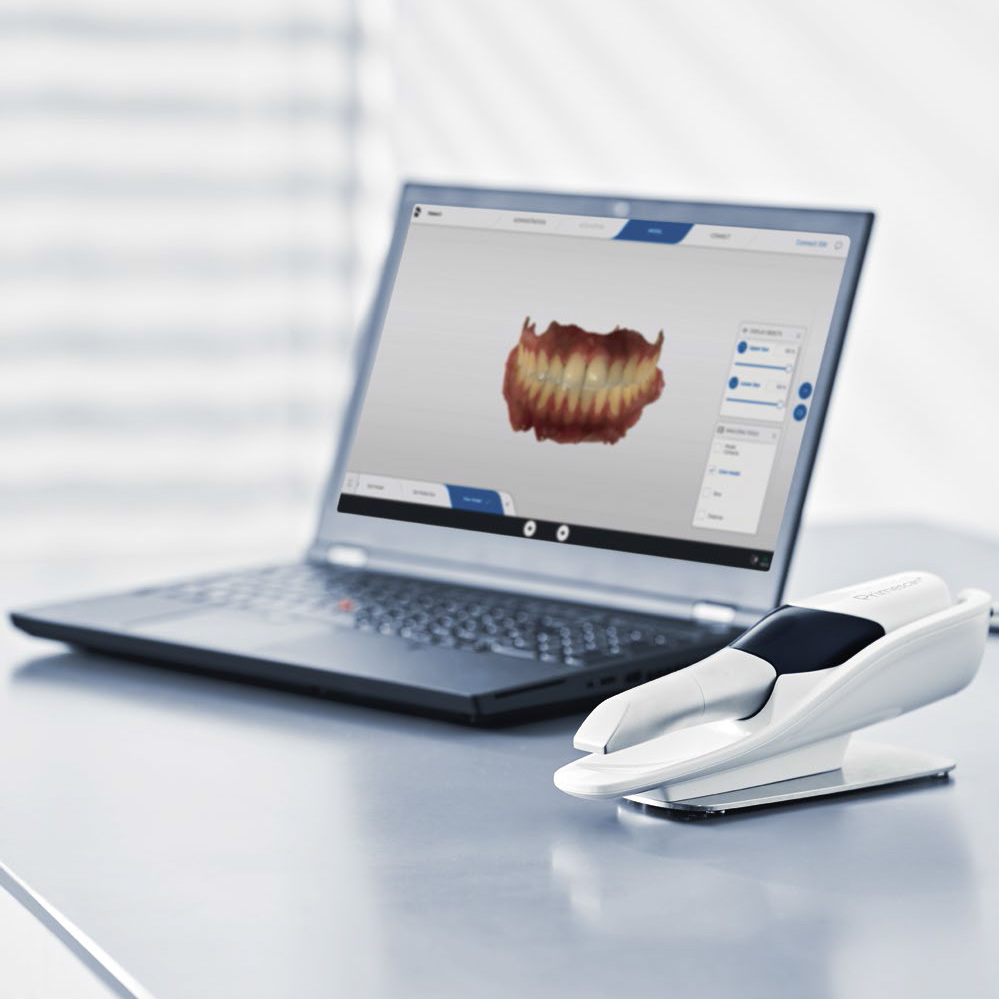 Сканер інтраоральний Primescan Connect (Dentsply Sirona). Ноутбук-конфігурація; інтраоральний, цифровий, оптичний сканер для отримання цифрових відбитків; з програмним забезпеченням Connect, можливість експорту даних в STL